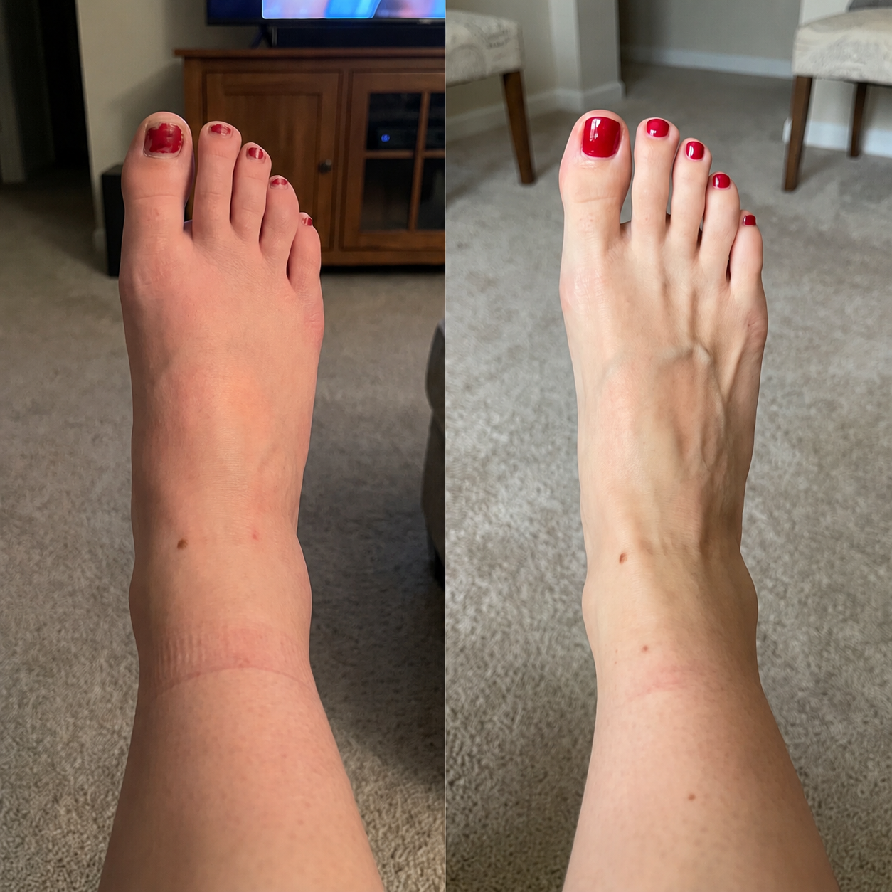Lymphsupport Wellness Tropfen
